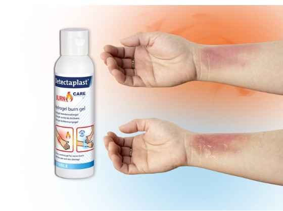 Detectaplast Burn Gel - Pbm's - Ehbo